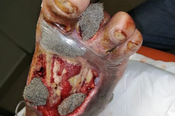 casos-exito-clinica-gala