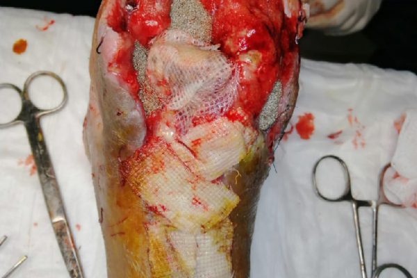 casos-exito-clinica-gala_2