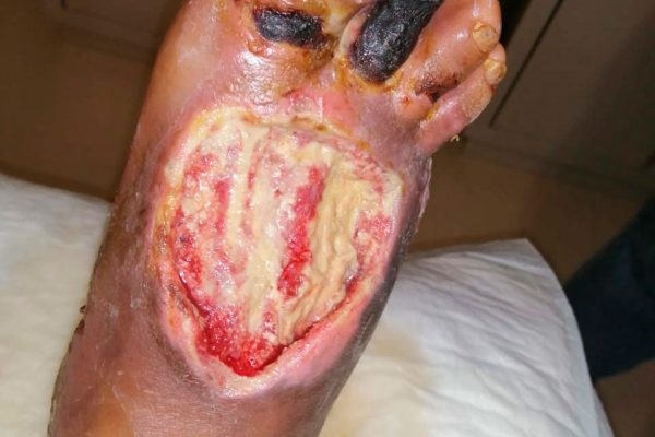 2-casos-exito-clinica-gala