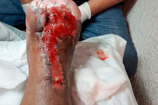 4-casos-exito-clinica-gala