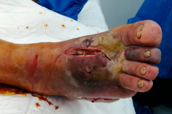 inicial-casos-exito-clinica-gala